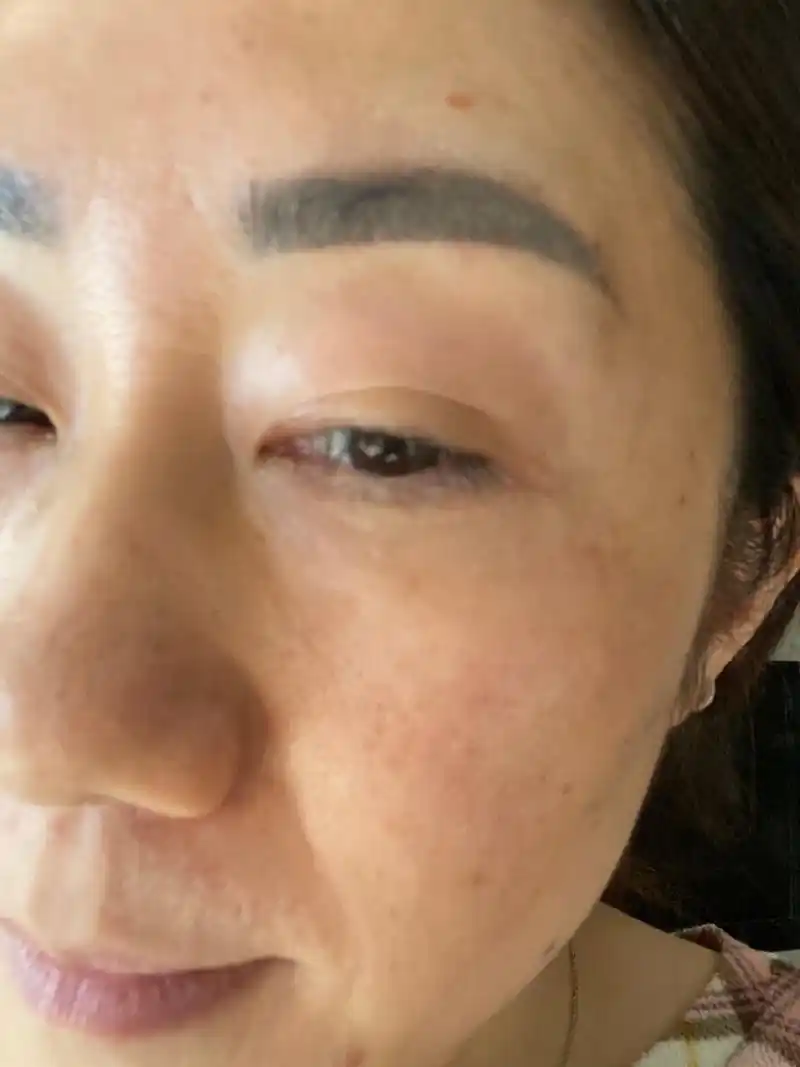 🌞脸上的斑斑点点,皮肤暗沉发黄真的看不下去了,咨询_圈子-新氧美容