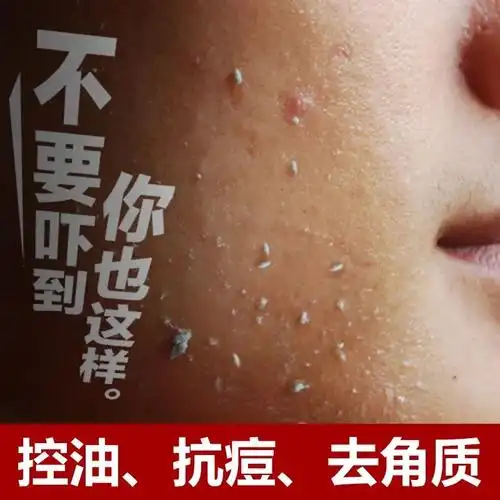 磨砂洗面奶女 去角质_去角质去死皮膏脸部面部全身好吸收洗面奶磨砂