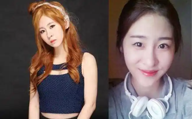 歌星张碧晨整容前后 大把网友不相信没整容