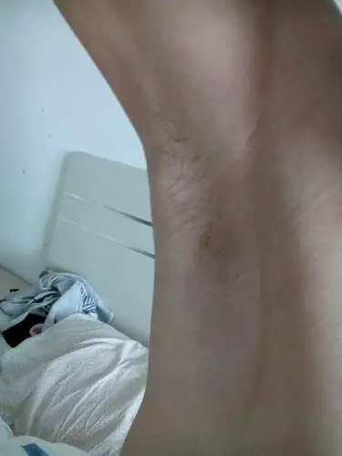 男腋毛长这么些,还能长个吗,你们多大腋毛是长这么些的?