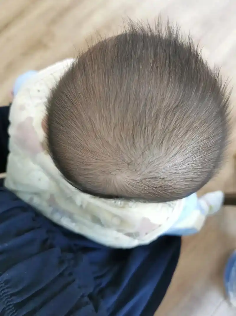 宝宝头型 #头型睡扁了  一不小心把宝宝的后脑勺睡成了平底 - 抖音