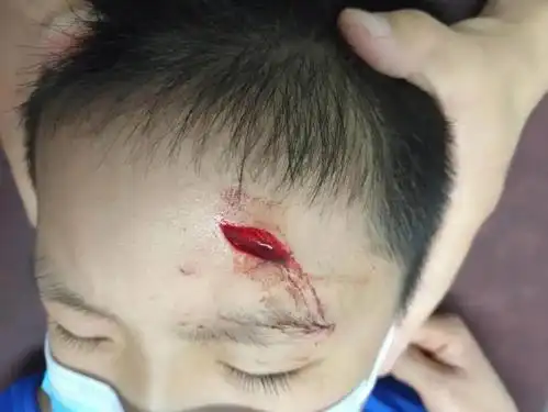 儿外科科普时间孩子头部磕伤了怎么办