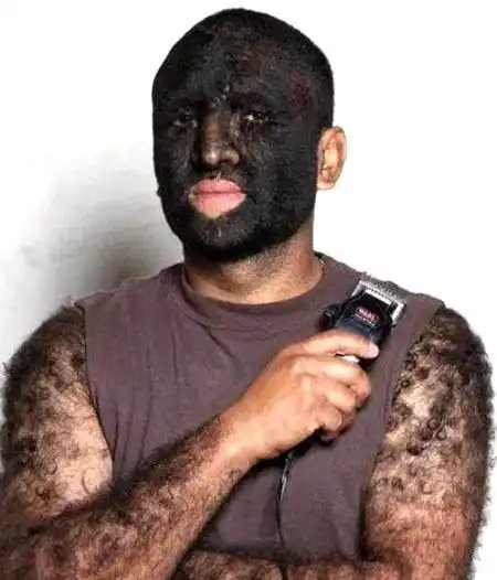 世上体毛最长的人 剪了后是个美女