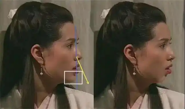 同理,一个嘴凸且下巴后缩的人,只要微微延长下巴,就可以让侧面型更加