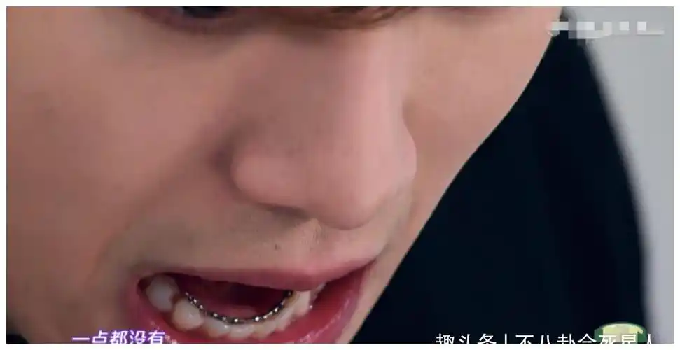 肖战坚持戴牙套两年和4年前刚出道的他相比颜值提升变化大