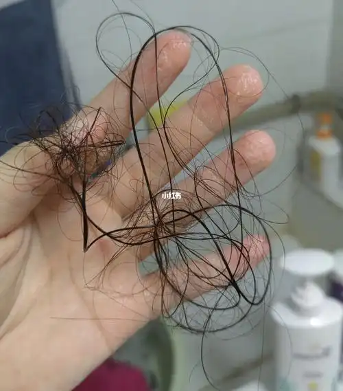 谁一缕一缕地掉头发啊