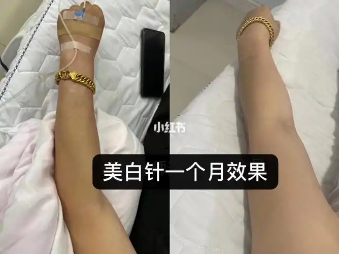 美白就在此刻_美白_美白针_美妆_医美整形