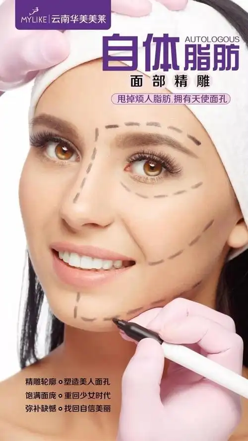 自体脂肪填充,重拥少女面孔【昆明美莱】