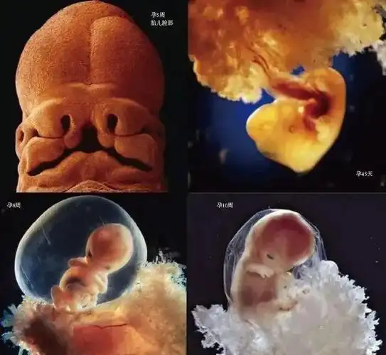 10月胎儿形成全过程,8张图带你了解真相,感受生命的奇迹|怀孕|卵子