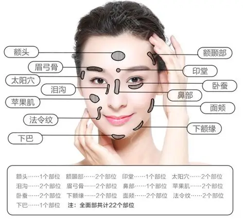 【自体脂肪面部填充】单部位 ,【svf脂肪胶 鲜活脂肪】秒杀prp超纳米