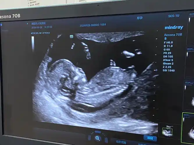 nt看男女有宝妈会看nub点嘛