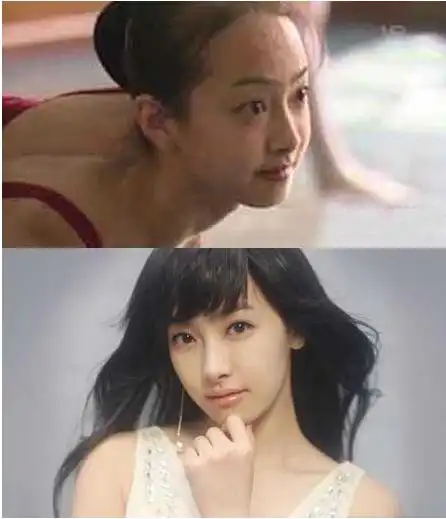 宋茜整容前后对比照
