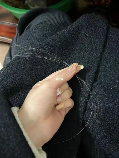 白头发拔一根会长三根