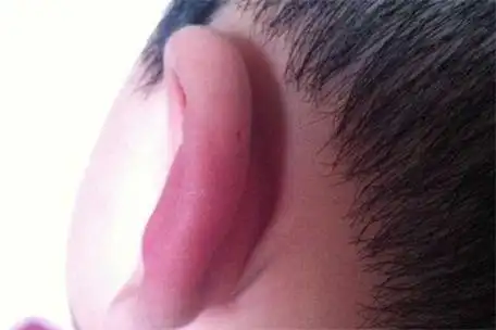 老人常说宝宝这种耳朵是福气象征,事实真如此?