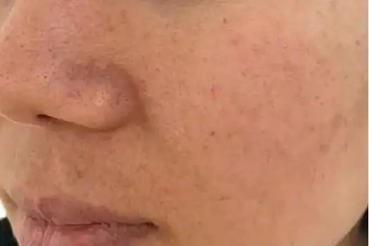 皮肤粗糙暗黄?教您几招儿,皮肤嫩滑白哲