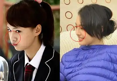 郑爽整容部位鉴定 4部位疑似整容