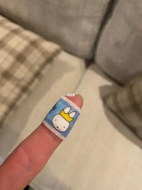 两天三次弄伤手是喜欢我的创口贴吗