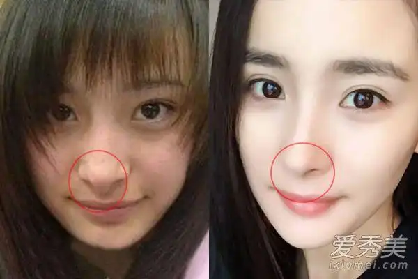 杨幂整容前后照片
