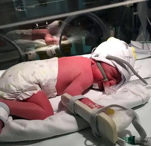 六个半月的胎儿生下来能活吗