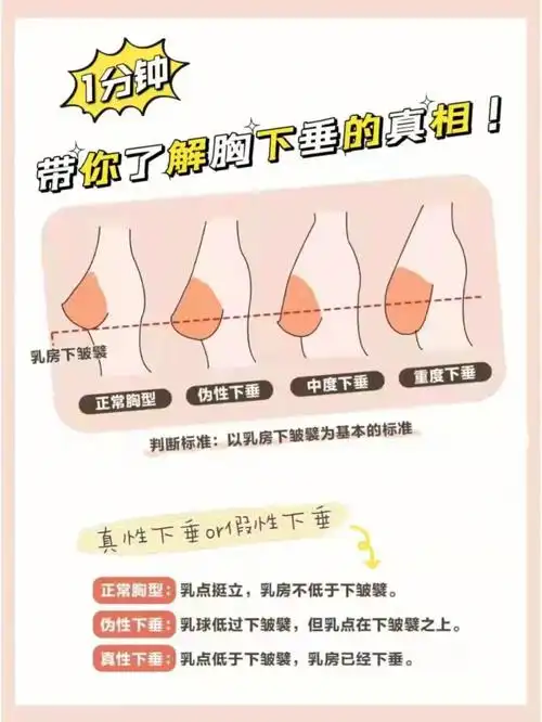 1分钟带你了解胸下垂的真相