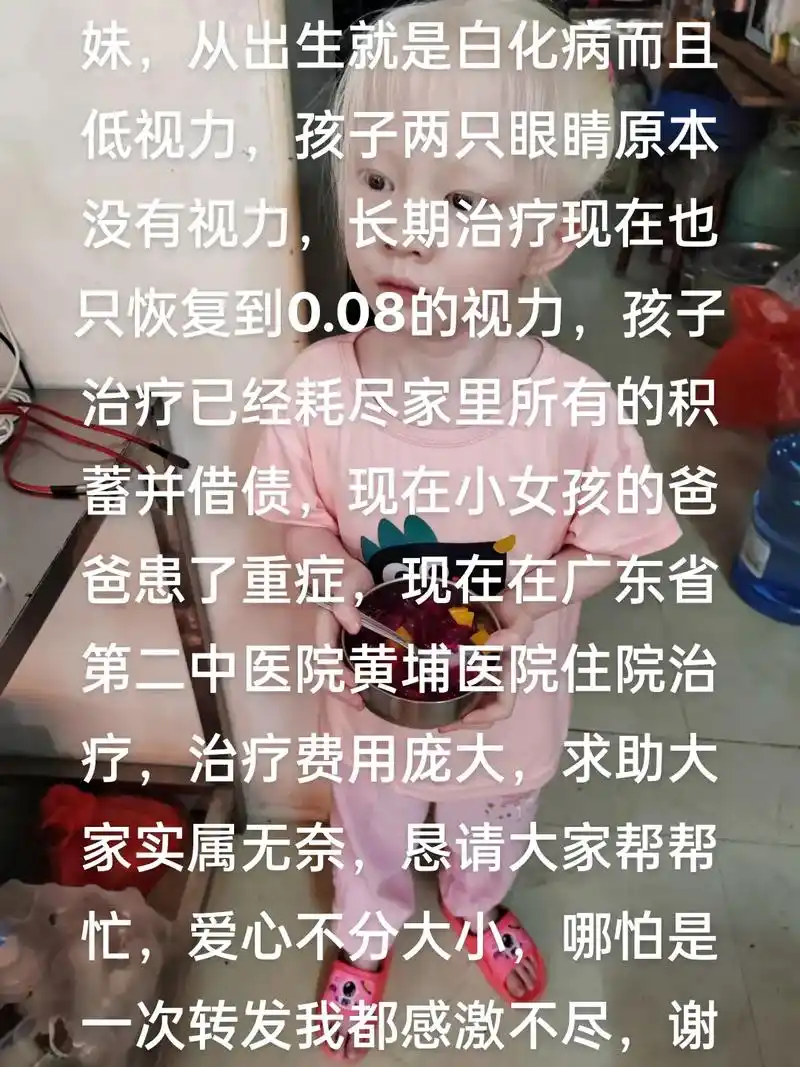 这个5岁小女孩是我的小表妹,从出生就是白化病而且低视力,孩子 - 抖音