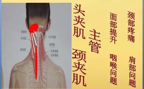 第三步:肩胛提肌 (侧卧位 1.斜线连接 2.拉伸颈侧的筋)