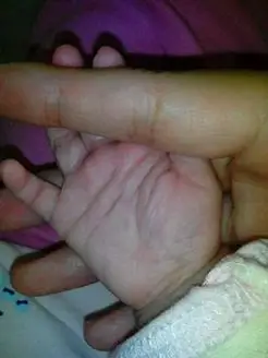 看看俺姑娘右手手纹是怎麼回事_宝宝树