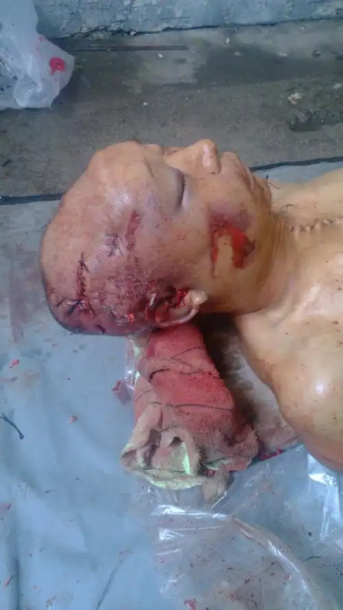 废弃的旧村委会,处遭到一伙不明身份人员殴打,颅脑严重损伤,脑浆迸裂