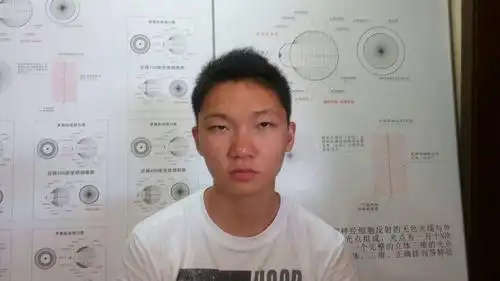 高度近视特高度近视的重生