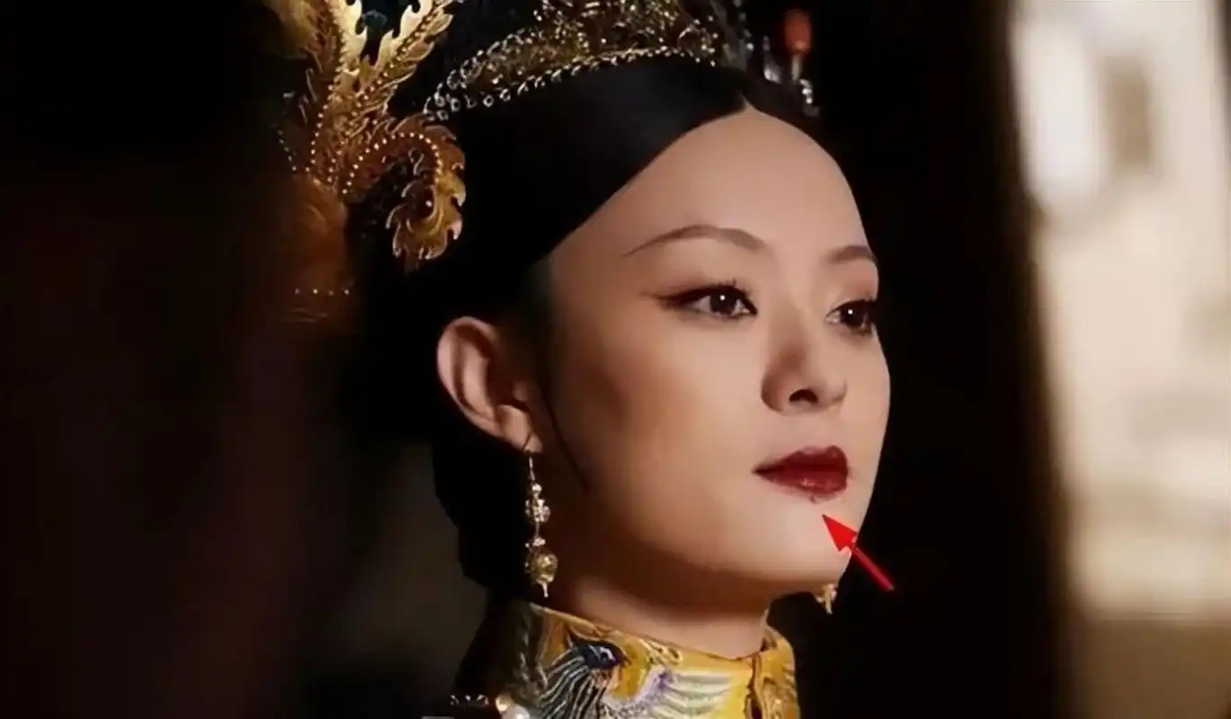 金秋图文动态创作节# 长着"美人痣"的女明星之孙俪  之前的孙俪脸上