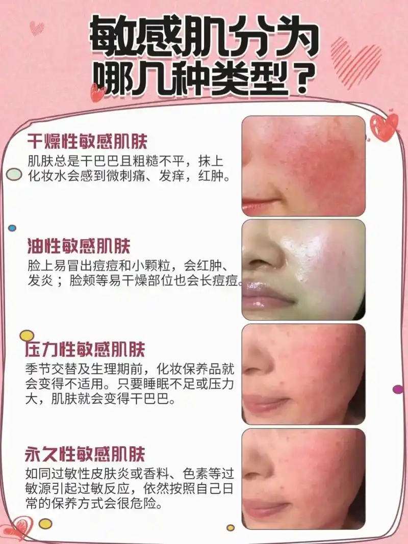 敏感肌皮肤屏障修复 #我的护肤干货 #敏感肌修护 #知识分 - 抖音