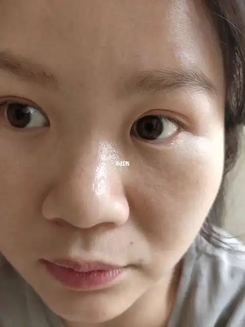 这种皮肤状态多少岁