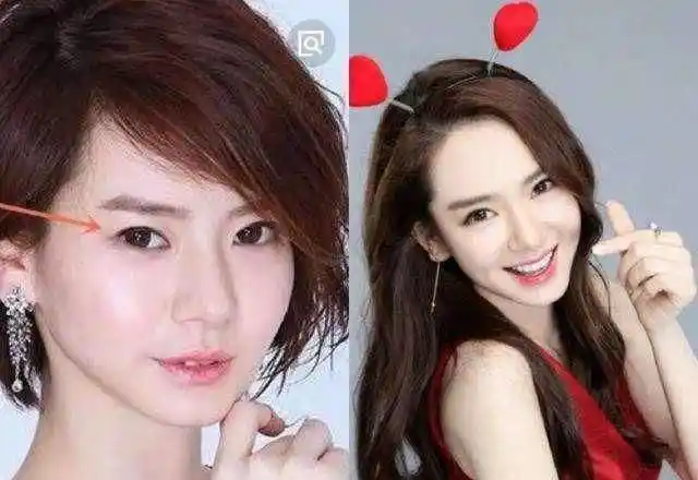 戚薇整容前后(戚薇整容前的样子)