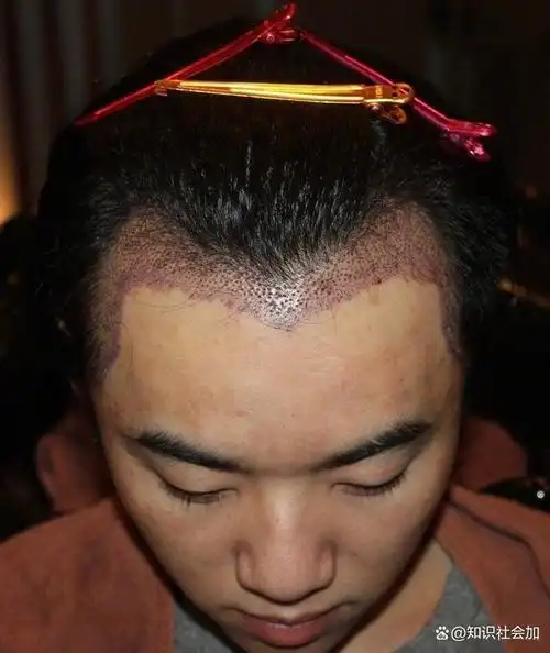 黄子韬在与她合作时,不仅暴露了她秃头的问题,还展现了与《三生三世十