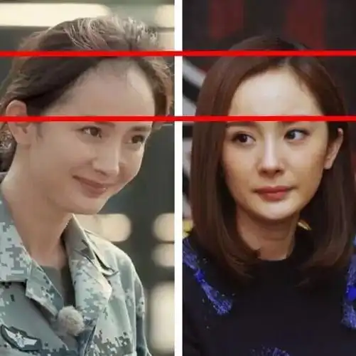 解决发际线后移的3大方法必看