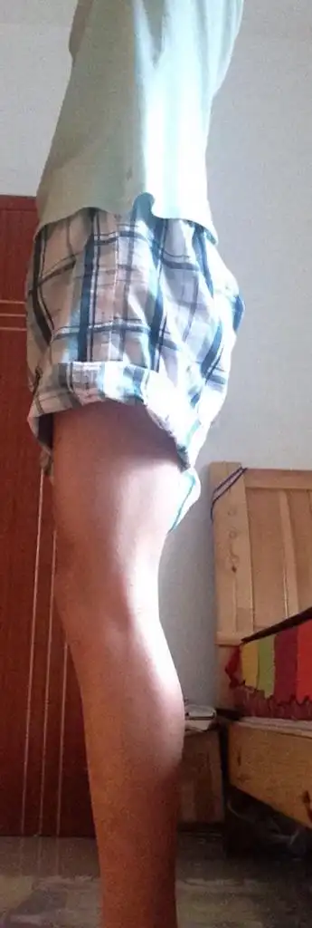 腿不直 膝盖那里站不直 站立起来看起来是弯的 今