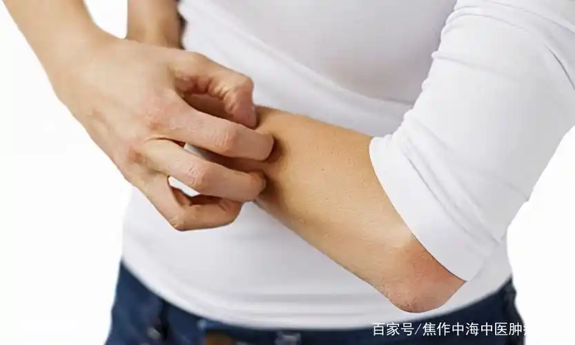 皮肤出现这些症状,可能是癌症的前兆