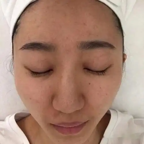 02肤色暗黄无光