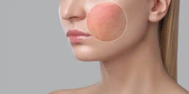 皮肤屏障受损的元凶真相令人意外