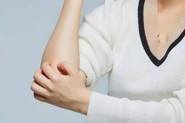 特应性皮炎,皮炎,皮肤问题,皮肤问题,抓挠,皮肤科图片下载