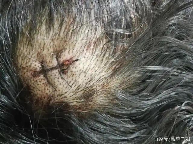 辽宁丹东市73岁老人被邻居砍伤,邻居逍遥法外,声称自己有神经病