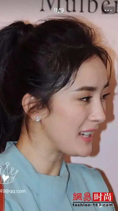 杨幂下巴又变了这次要回归自然 杨幂取掉了假体?