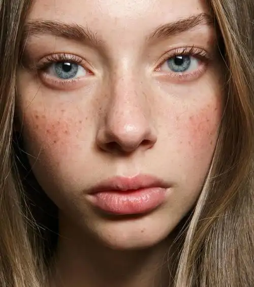 敏感肌肤该如何回归护肤美白