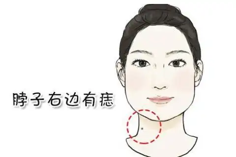 脖子上痣的位置图解