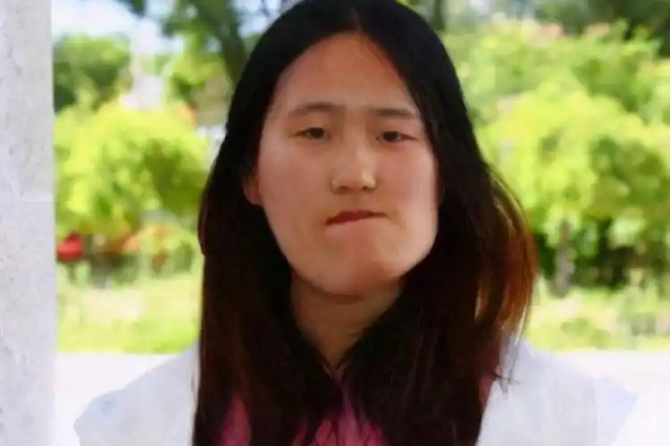 歪脸女孩现状如何整容后成美女拒绝百万年薪仍当老师