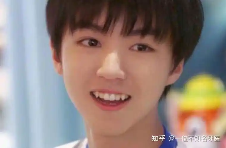 虎牙可以磨平吗为什么会有虎牙虎牙能拔吗