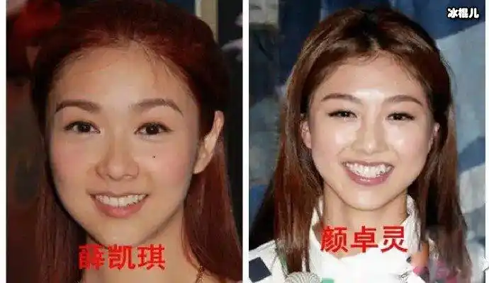 颜卓灵有虎牙,是比较可爱,小女生的路线