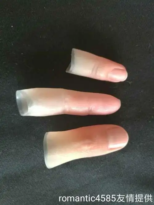 我的手可以安装三d假肢吗?