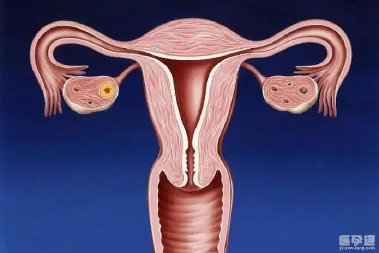 后天子宫畸形还可以怀孕吗这个首要任务一定要先解决