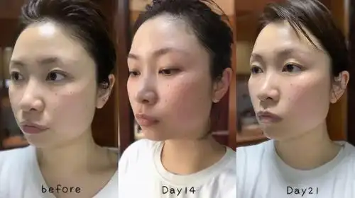 真人对比图上海的天气一下子就变热了,防晒美白这个事情又一次提上了